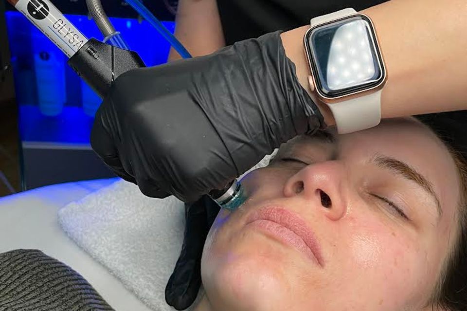 Unveiling the Power of Facials: A Skincare Revolution