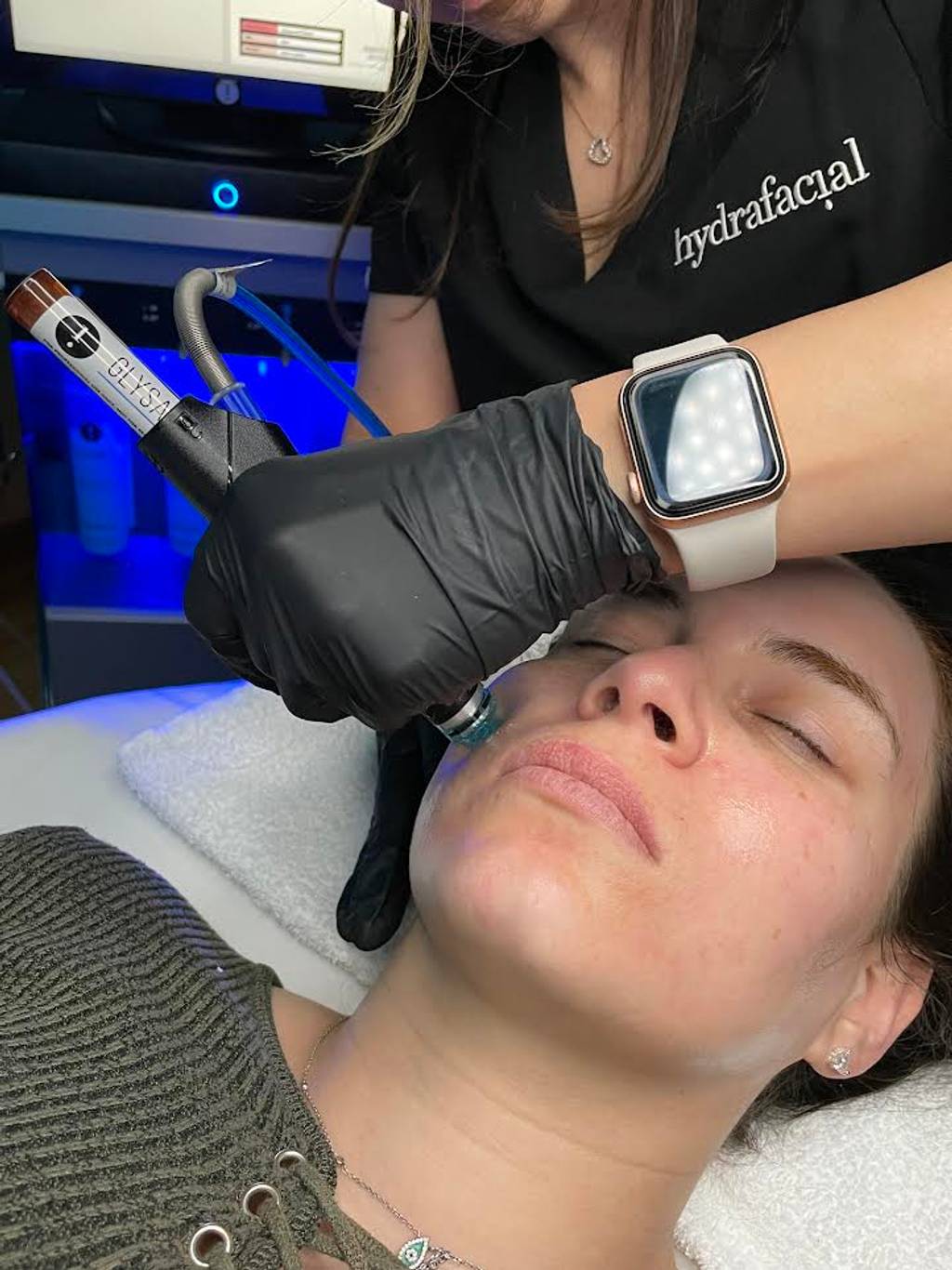 HydraFacial acne treatment results at Saije Esthetics Beaverton - before and after congestion improvement
