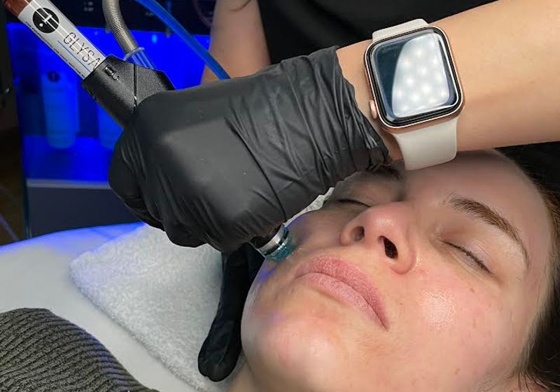 Unveiling the Power of Facials: A Skincare Revolution