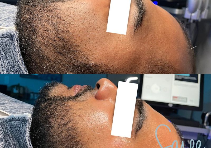 Not Just for the Ladies: The Rise of Facials for Men
