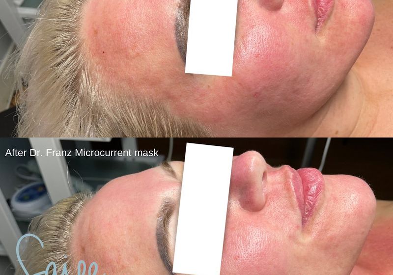 Dr. Franz Micro-current Masks
